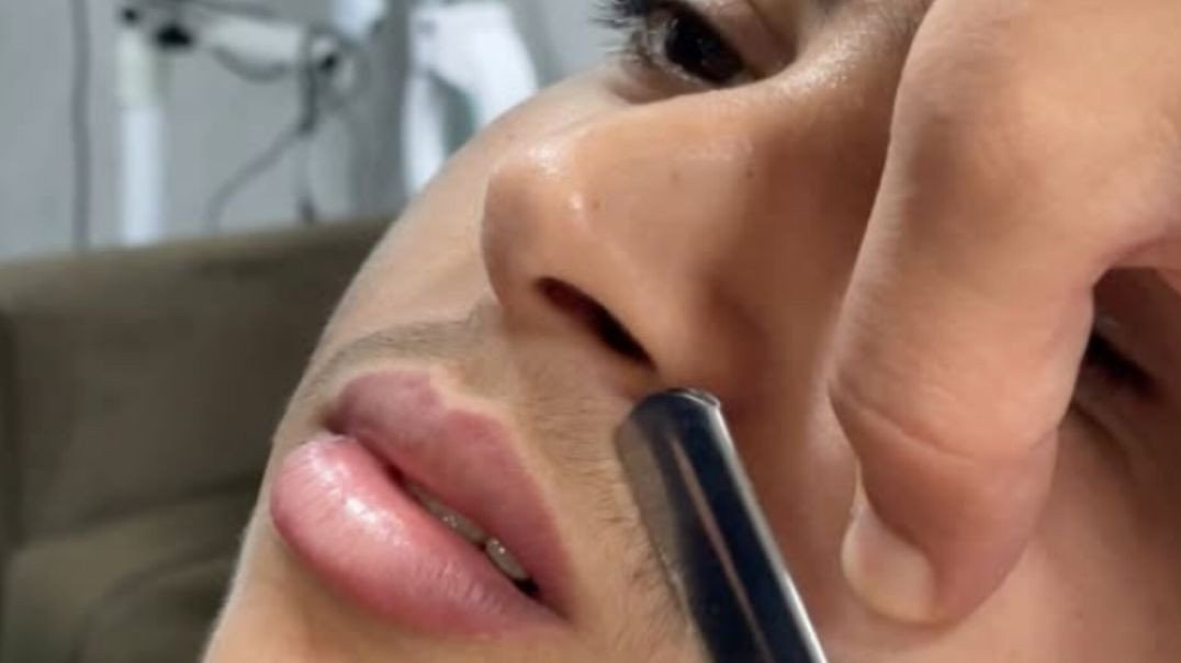 Hoje! Fazendo o Bigode