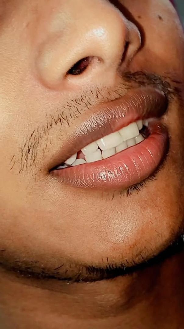 Meu Sorriso Sem Graça! #boy